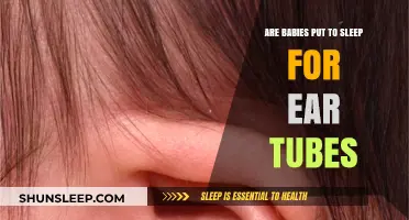 Ear Tubes for Babies: Understanding the Need for Sedation