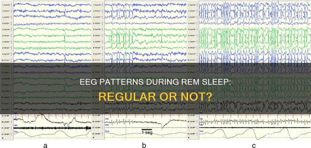 are eeg pattern regular during rem sleep