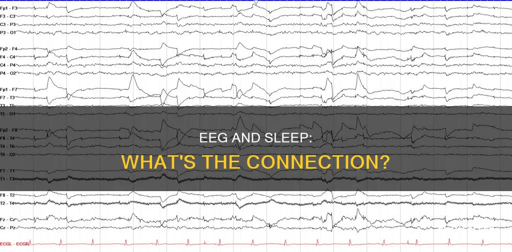 are eegs done suring sleep study