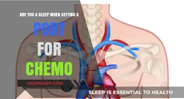 Staying Comfortable: What to Expect When Getting a Port for Chemo