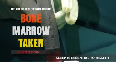 Bone Marrow Procedure: Understanding Sleep and Pit Concerns During Extraction