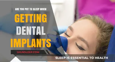 Dental Implants and Anesthesia: Understanding Sedation During Implant Procedures