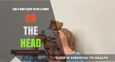 Baby Head Bump: Safe Sleep Tips After a Minor Injury