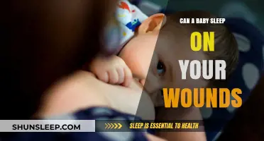 Can Babies Sleep on Your Wounds? Safety and Healing Considerations