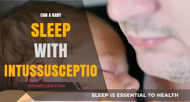Can Babies Sleep Safely with Intussusception? Expert Insights and Advice