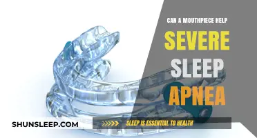 Can Mouthpieces Effectively Treat Severe Sleep Apnea? Expert Insights