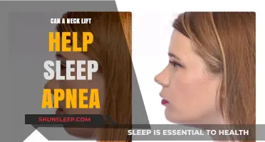 Neck Lift Surgery: A Potential Solution for Sleep Apnea Relief?