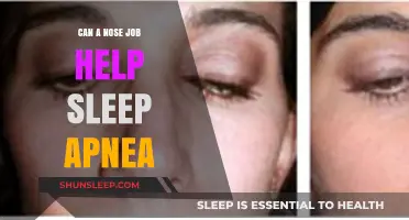 Nose Job for Sleep Apnea: A Potential Solution for Better Sleep