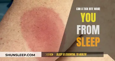 Tick Bite Terror: Can It Wake You From Sleep?