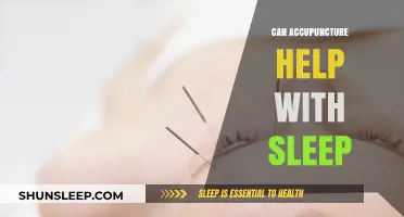 Acupuncture for Better Sleep: Natural Relief for Insomnia and Restlessness