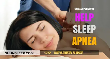 Acupuncture for Sleep Apnea: A Natural Remedy for Better Rest?