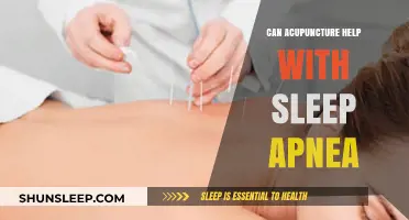 Acupuncture for Sleep Apnea: A Natural Solution for Better Rest?