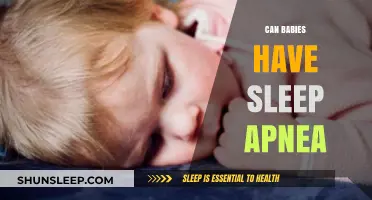 Can Babies Have Sleep Apnea? Understanding Infant Sleep Disorders