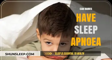Can Babies Have Sleep Apnoea? Understanding Infant Sleep Disorders