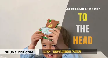 Babies and Head Bumps: Safe Sleep Guidelines After Minor Injuries