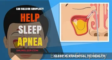 Balloon Sinuplasty and Sleep Apnea: Exploring the Connection for Better Sleep