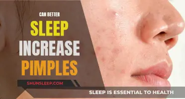 Sleep Quality and Pimples: Is There a Connection?