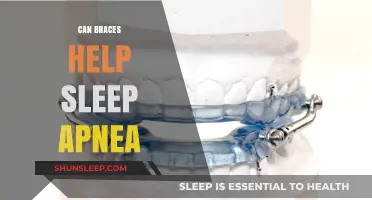 Braces as a Potential Sleep Apnea Treatment: What You Need to Know