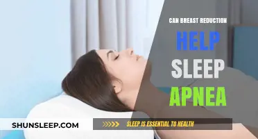 Breast Reduction Surgery: A Potential Solution for Sleep Apnea Relief?