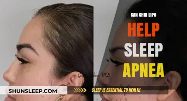 Chin Lipo and Sleep Apnea: Exploring Potential Benefits for Better Sleep