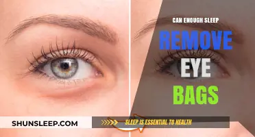 Sleep and Eye Bags: The Connection