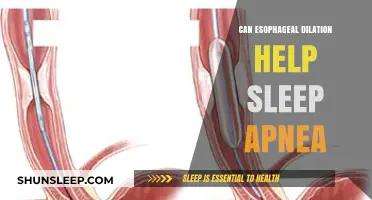 Esophageal Dilation: A Potential Sleep Apnea Treatment Solution?