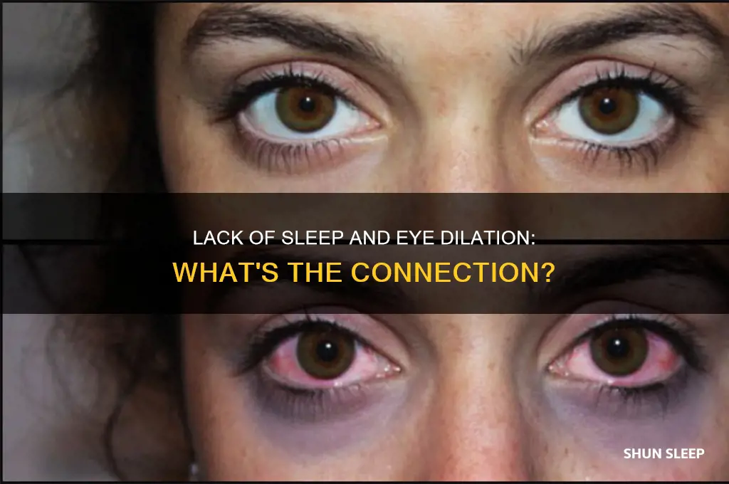 can eyes get dilated if you don