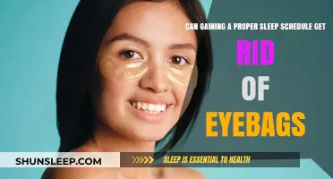 Proper Sleep Schedule: The Key to Eliminating Stubborn Eyebags?