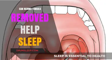 Tonsillectomy and Sleep: Can Removing Tonsils Improve Rest Quality?