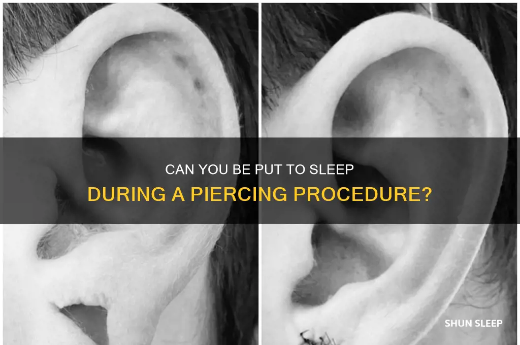 can i be put sleep while getting a piercing
