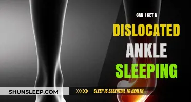 Can Sleeping Cause a Dislocated Ankle? Unraveling the Myth and Facts