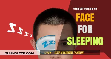 Can Sleeping Habits Trigger Facial Acne? Uncover the Surprising Truth