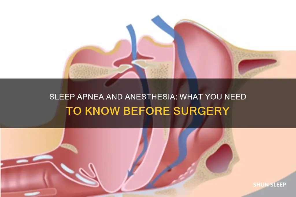 can i get anesthesia if i have sleep apnea