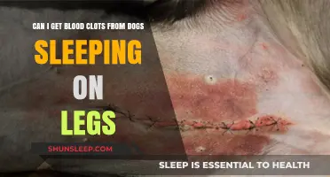 Can Dogs Sleeping on Your Legs Cause Blood Clots?
