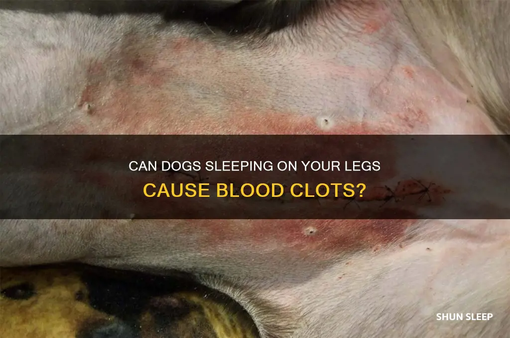 can i get blood clots from dogs sleeping on legs