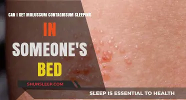 Sleeping in Someone's Bed: Moluscum Contagiosum Transmission Risk Explained