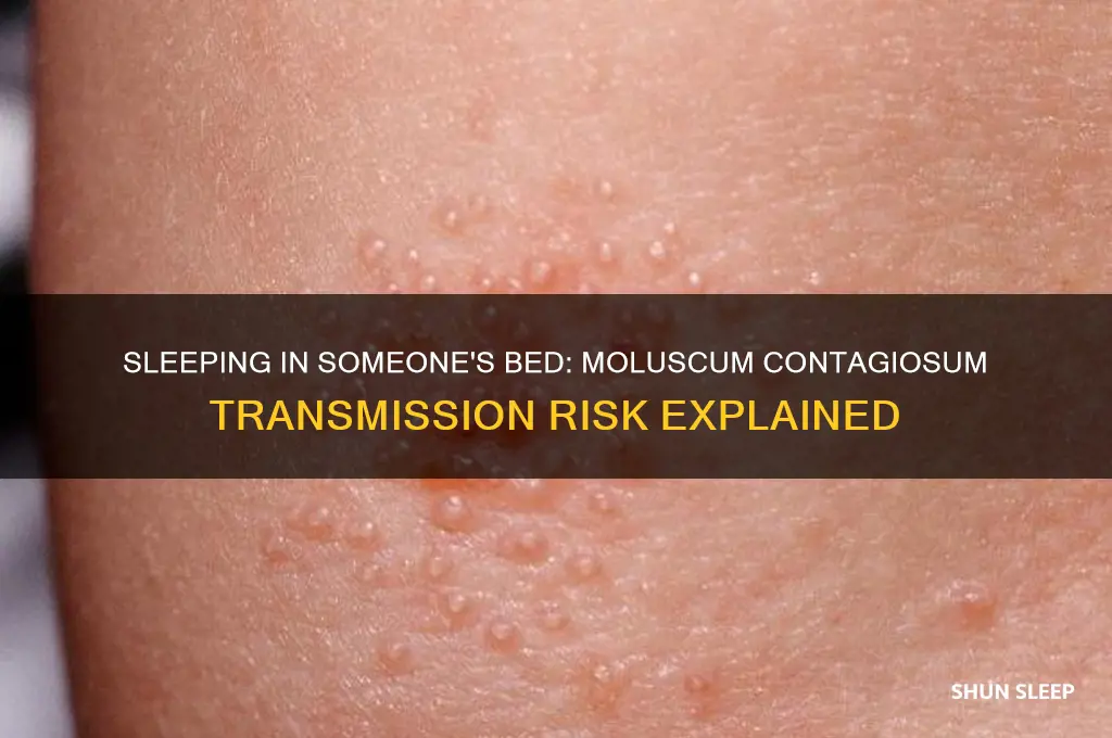 can i get moluscum contagiosum sleeping in someone