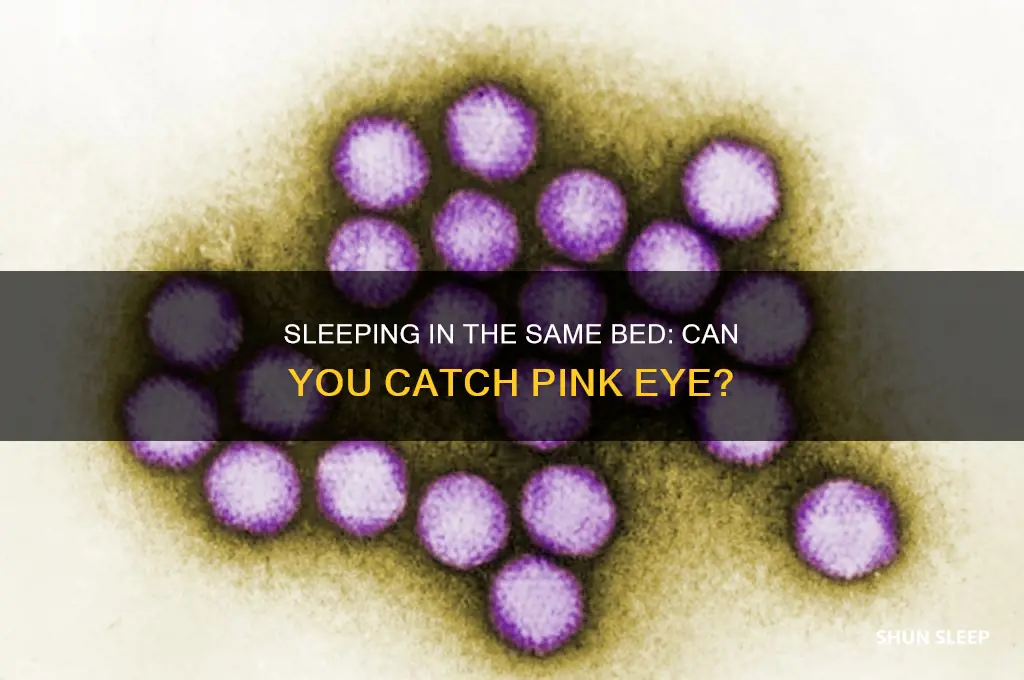 can i get pink eye from sleeping in same bed