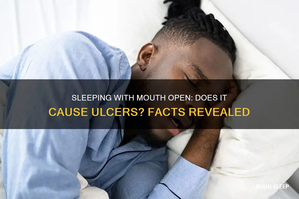 can i get ulcers from sleeping with my mouth open