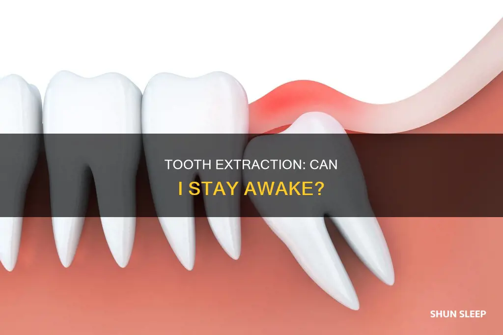 can i have tooth extraction without sleep