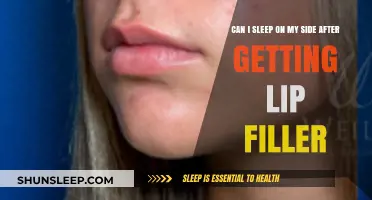 Sleeping on Your Side After Lip Fillers: What You Need to Know