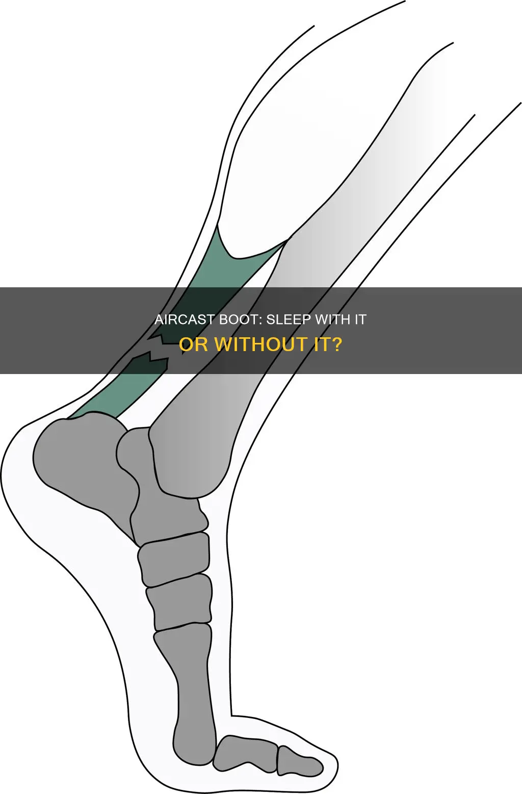 can i sleep without my aircast boot