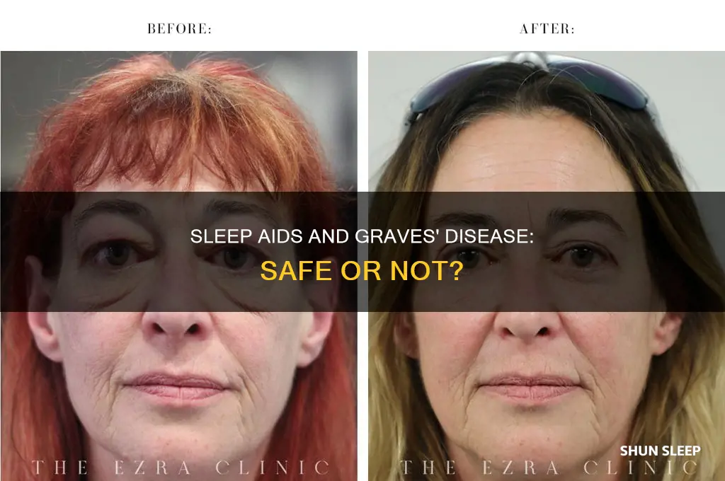 can i take sleep meedicine with graves disease