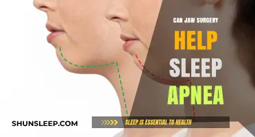 Jaw Surgery for Sleep Apnea: A Potential Solution for Better Sleep