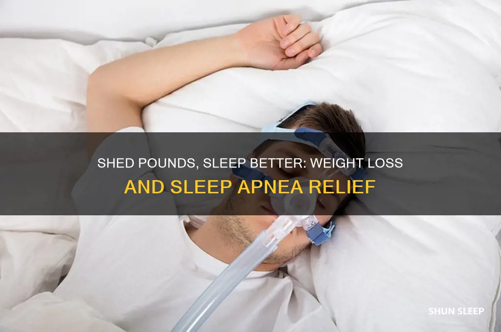 can losing weight help with sleep apnea