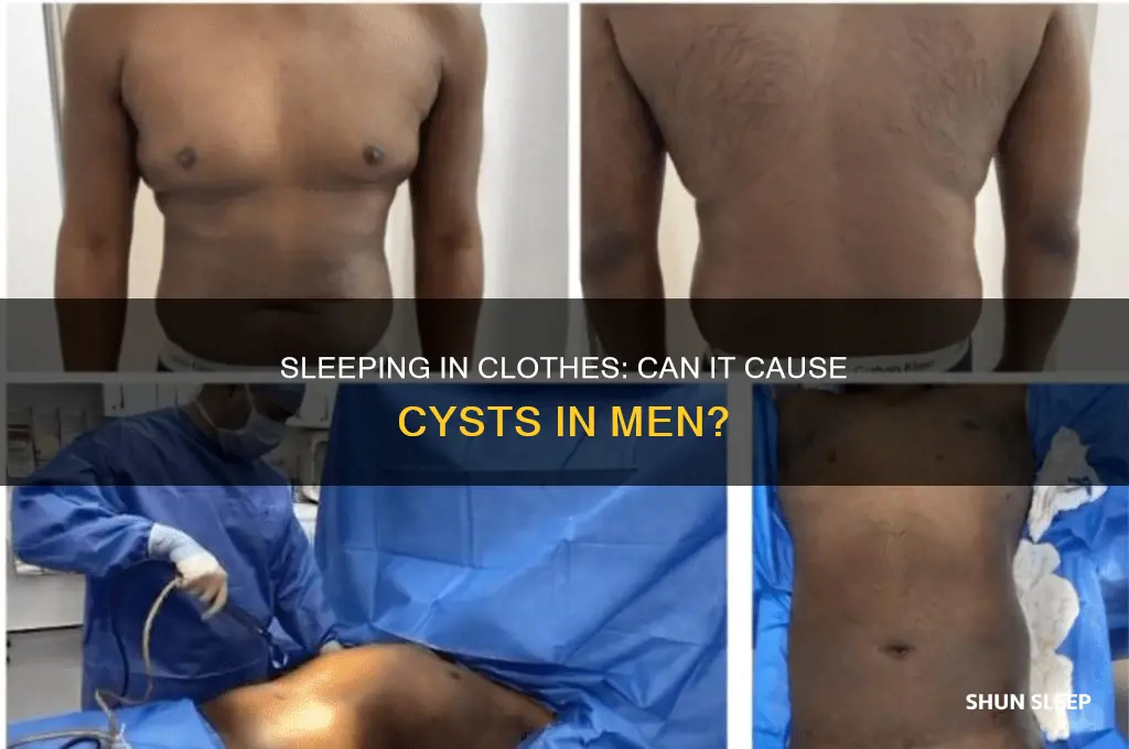 can men get cysts by sleeping in there clothing