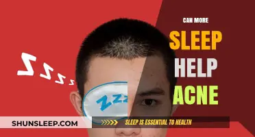 Sleep and Skin: Can More Rest Improve Your Acne?