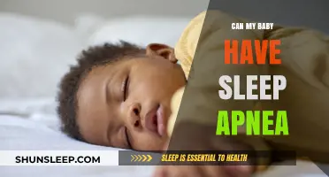 Can My Baby Have Sleep Apnea? Understanding Infant Sleep Disorders