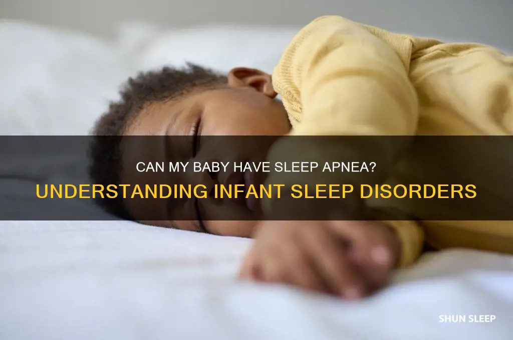 can my baby have sleep apnea