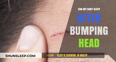 Baby Head Bump: Is It Safe for Them to Sleep After?